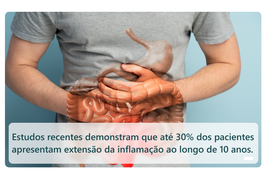 imagem de pessoa com as mãos na altura do intestino