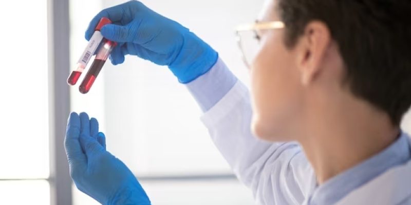 Enfermeira analisando exame laboratorial.